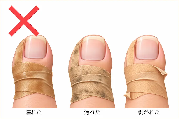 テープが濡れたり、汚れたり、剥がれてきた様子のイラスト