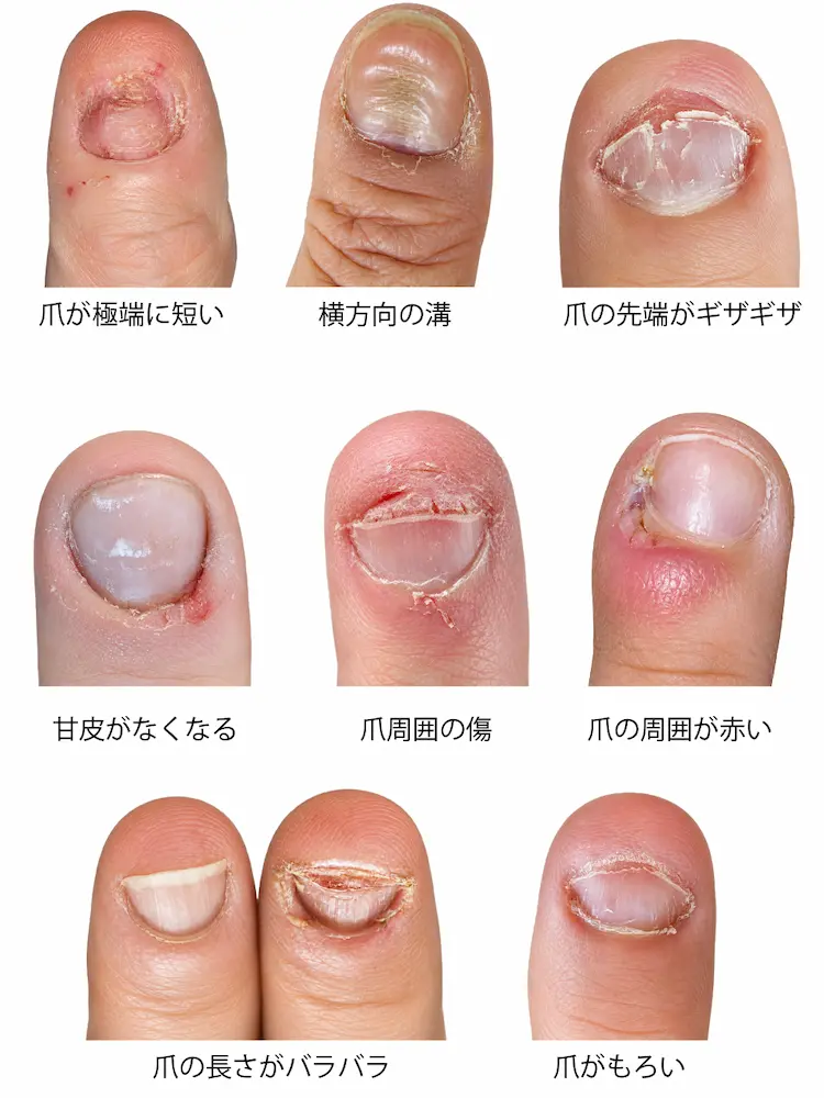爪むしりの症状の写真