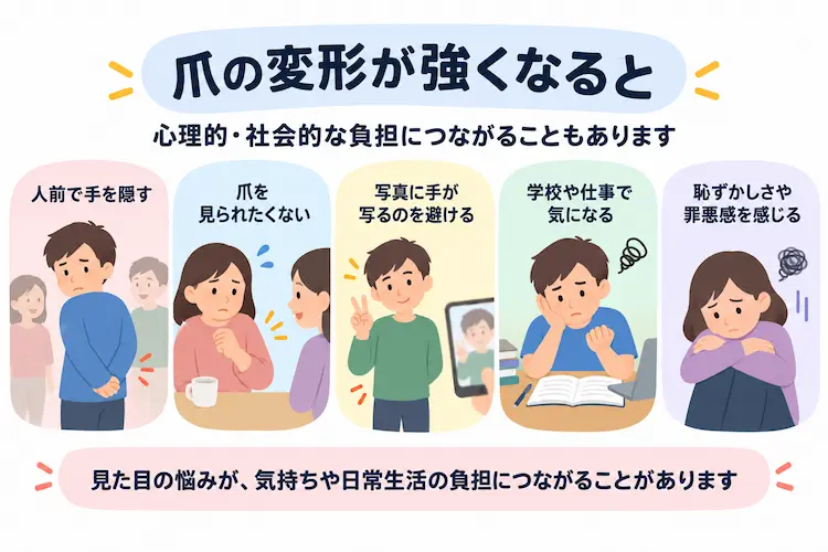 人前で手を隠す爪を見られたくない写真に手が写るのを避ける学校や仕事で気になる恥ずかしさや罪悪感を感じる様子を描いたイラスト