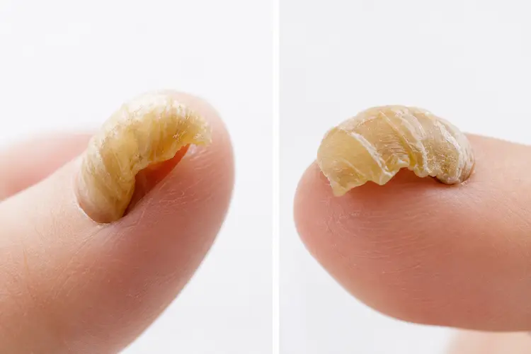 爪が何重にもなって厚く丸くなっている様子