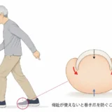 高齢者の歩行と爪への影響を示したイラスト