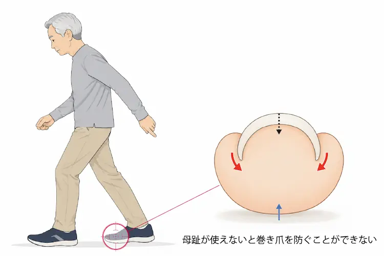高齢者の歩行と爪への影響を示したイラスト