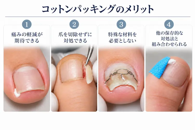 コットンパッキングのメリット