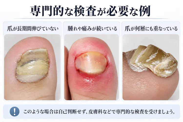 専門的な爪の検査が必要な例