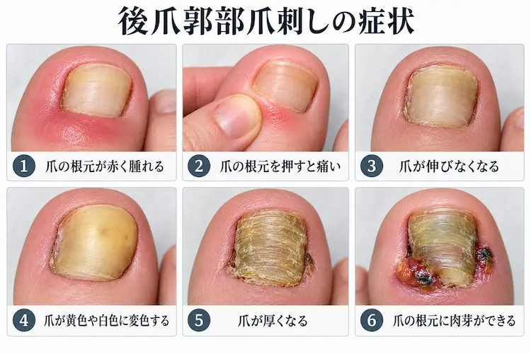 後爪郭部爪刺しの症状