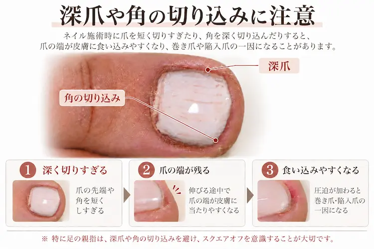 深爪と角の切り込み注意ポスター
