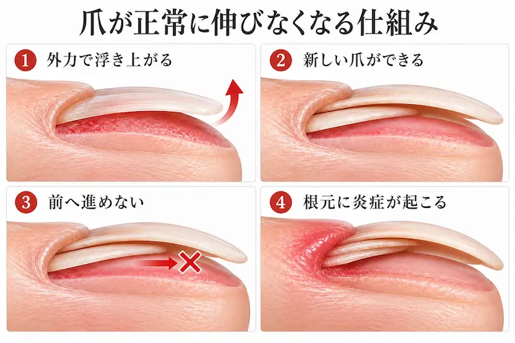 爪が正常に伸びなくなる仕組み