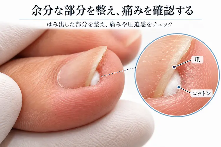 爪とコットンの確認図