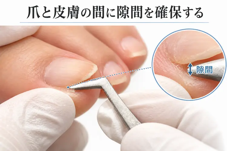 爪と皮膚の隙間を確認する図