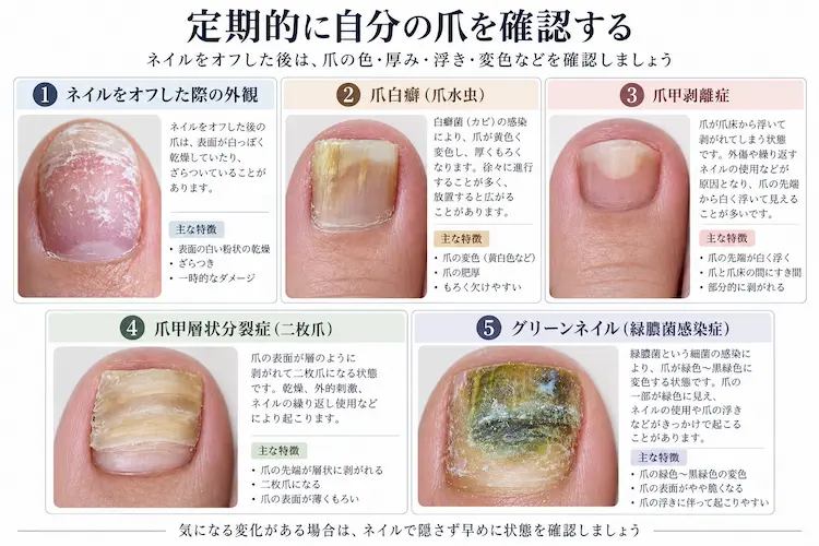 爪の状態を知る健康ガイド