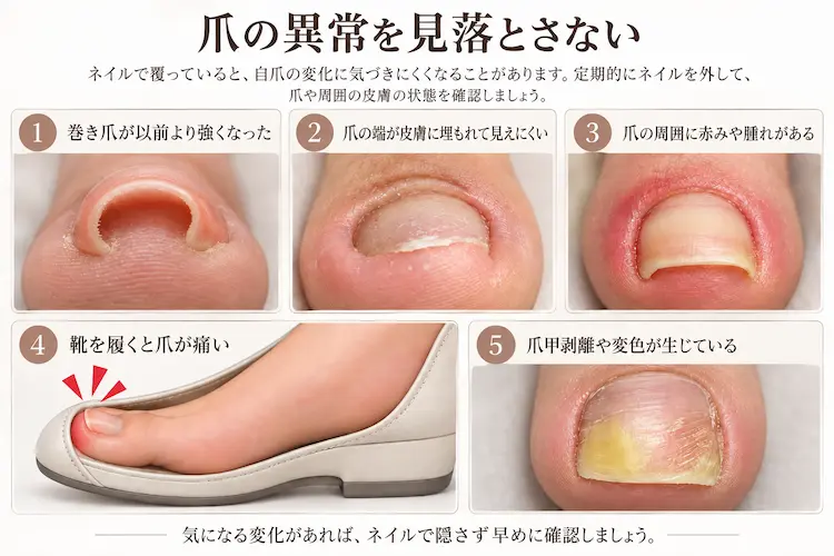 爪の異常を見落とさない