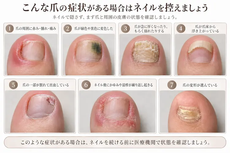 爪の症状を確認する医療ガイド