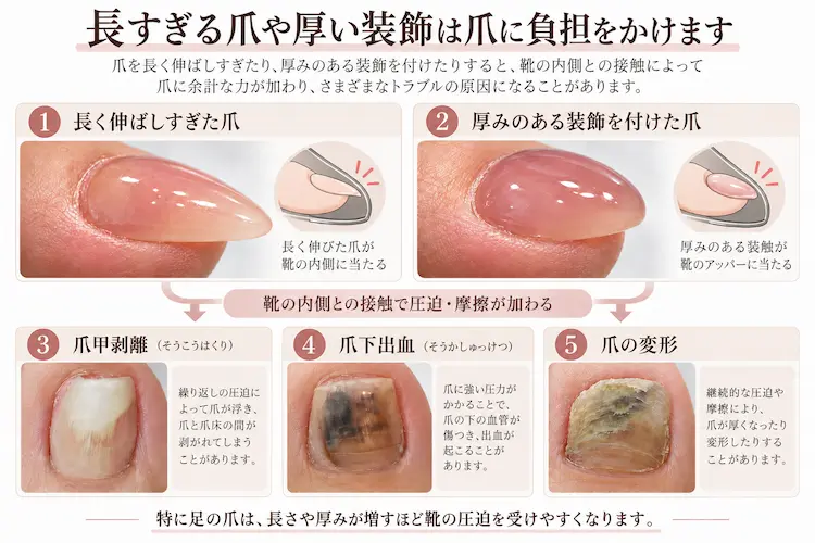 爪への負担とトラブル解説